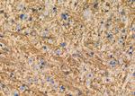 GluR6 Polyclonal Antibody