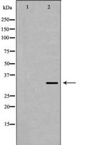 RPL5 Antibody in Western Blot (WB)