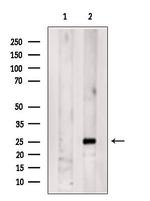 Serum Amyloid P Polyclonal Antibody