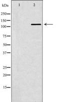 SMARCA5 Polyclonal Antibody