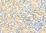 Cbl-b Polyclonal Antibody