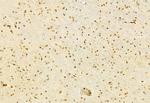 MT2A Antibody in Immunohistochemistry (Paraffin) (IHC (P))