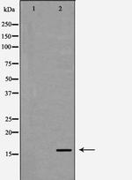 RPS19 Polyclonal Antibody