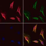 KPNA4 Polyclonal Antibody