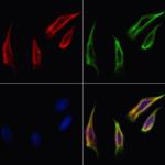 PVRL1 Polyclonal Antibody
