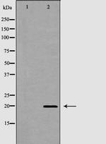 CD69 Polyclonal Antibody
