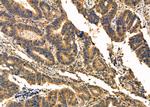 CAPZA2 Antibody in Immunohistochemistry (Paraffin) (IHC (P))