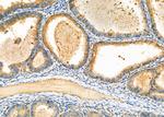 CAPZA2 Antibody in Immunohistochemistry (Paraffin) (IHC (P))