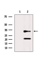 CAPZA2 Antibody in Western Blot (WB)