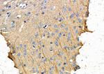 EPHX1 Polyclonal Antibody
