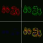 PDE1B Polyclonal Antibody