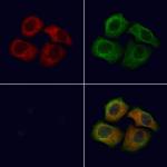 Thrombospondin 1 Polyclonal Antibody
