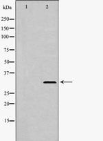 TRAIL Polyclonal Antibody