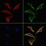 NUMBL Polyclonal Antibody
