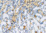 SCCPDH Antibody in Immunohistochemistry (Paraffin) (IHC (P))