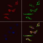 KBTBD3 Polyclonal Antibody