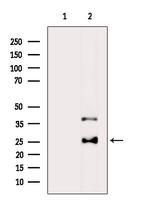 HLA-DQA1 Antibody in Western Blot (WB)
