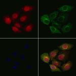 PP1 alpha Polyclonal Antibody