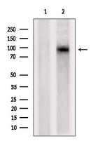 DLG7 Polyclonal Antibody