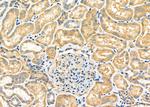 MRP4 Polyclonal Antibody