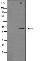 DCTN2 Polyclonal Antibody
