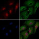 MDA5 Polyclonal Antibody