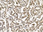 MDA5 Antibody in Immunohistochemistry (Paraffin) (IHC (P))