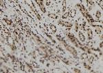 EPB41 Polyclonal Antibody