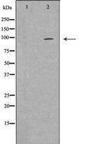 EPB41 Antibody in Western Blot (WB)