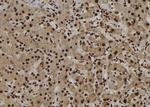 NUP62 Polyclonal Antibody
