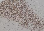 PSMC4 Polyclonal Antibody