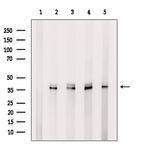 EEF1D Polyclonal Antibody