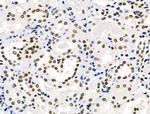 HEF1 Polyclonal Antibody