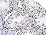 HEF1 Antibody in Immunohistochemistry (Paraffin) (IHC (P))