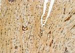 DKK3 Antibody in Immunohistochemistry (Paraffin) (IHC (P))