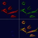 PCBP2 Polyclonal Antibody