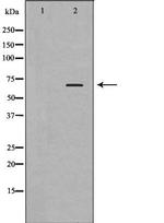 PLK1 Polyclonal Antibody