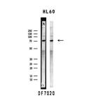 SLP76 Polyclonal Antibody