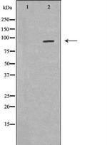 FES Polyclonal Antibody