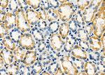 ALDH4A1 Polyclonal Antibody