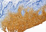 Cytokeratin 4 Polyclonal Antibody
