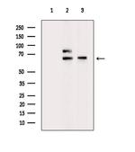 Cytokeratin 4 Antibody in Western Blot (WB)