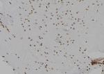 CDK20 Polyclonal Antibody