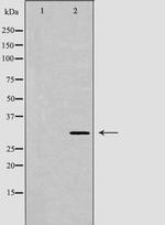 CDK20 Antibody in Western Blot (WB)