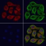 CLEC4A Polyclonal Antibody