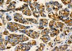 CLEC4A Antibody in Immunohistochemistry (Paraffin) (IHC (P))