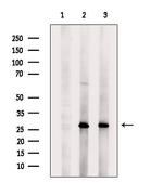 CLEC4A Antibody in Western Blot (WB)