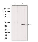 DLK1 Polyclonal Antibody