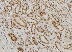 FAM81B Antibody in Immunohistochemistry (Paraffin) (IHC (P))