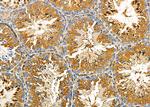 FAM81B Antibody in Immunohistochemistry (Paraffin) (IHC (P))